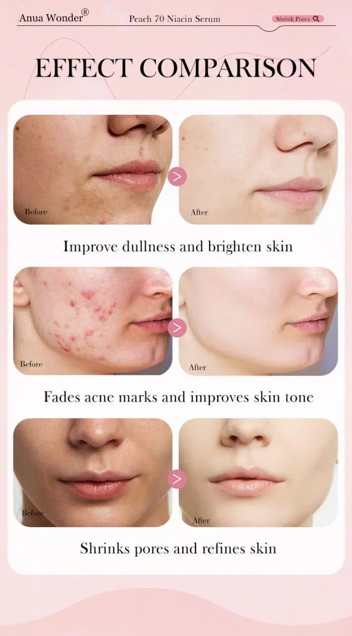 Anua Wonder Peach 70% Niacinamide Serum
